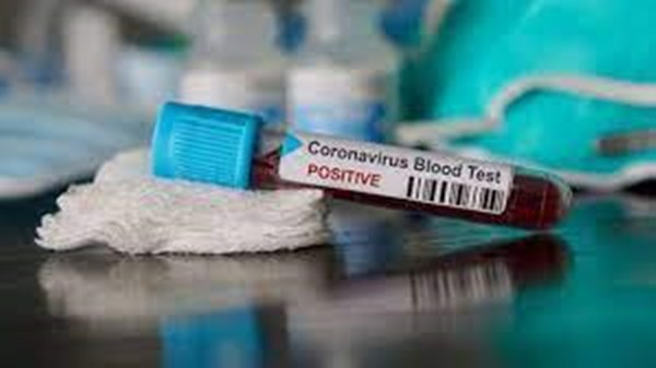 Mersin'de Koronavirüs Vaka Sayıları Artıyor